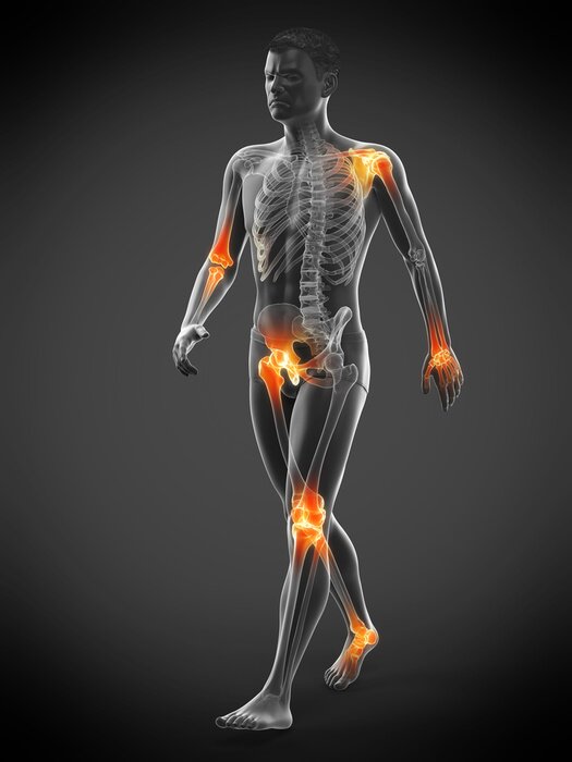 Bild Männliche Figur mit orange hervorgehobenen Gelenken